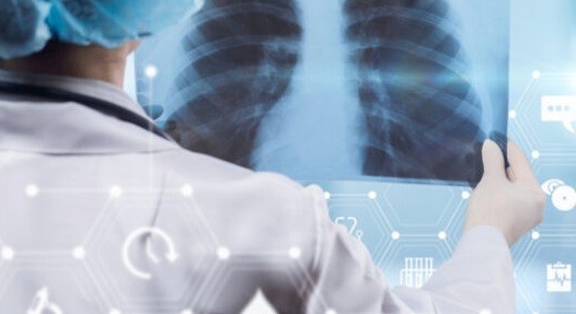 Пневмонія: основні симптоми та лікування